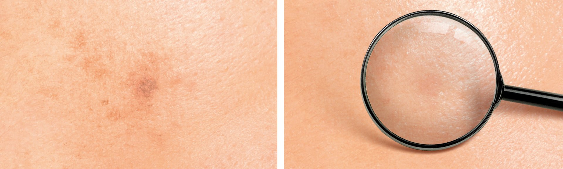 LorealmultimarcaSEO EDITORIAL OAP 2 BMX