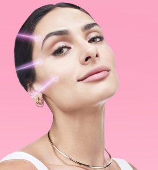 MELASMA