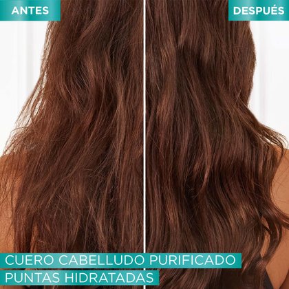 Antes y después Hialurónico Pure