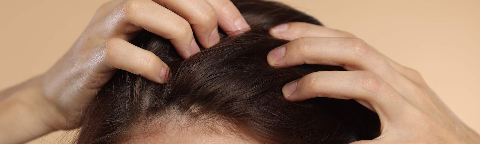 IMAGEN PORTADA: PERDIDA DE CABELLO DIARIO