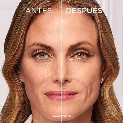 True Match Sérum L'Oréal Paris antes despues