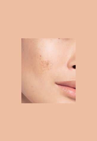 01 Before Nychaa Mobile